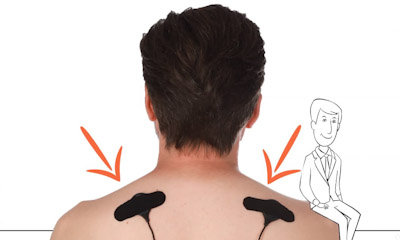 Die Elektroden des neoos lite an der Schulter angebracht